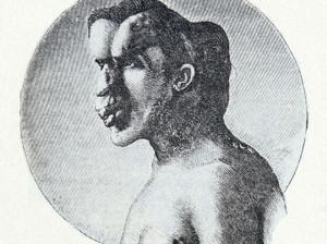 Elephant man